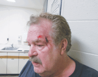  Larry White, 74, of Madison Heights, seen here bleeding after an encounter with Madison Heights police last year, is suing the department and four of its officers in federal court.  
