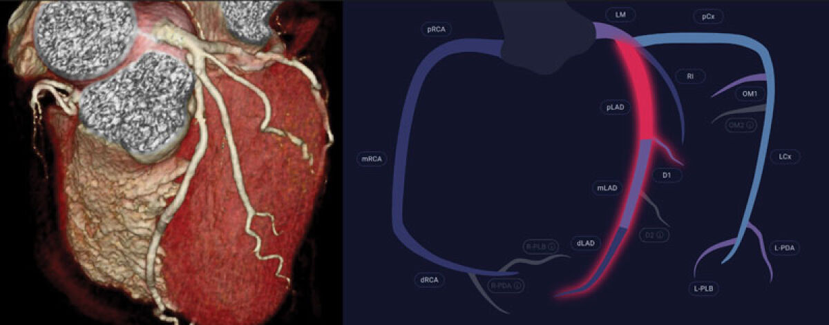  RMC recently became the first facility in Michigan to integrate a groundbreaking AI platform for diagnosing heart disease. 