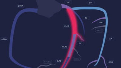  RMC recently became the first facility in Michigan to integrate a groundbreaking AI platform for diagnosing heart disease. 
